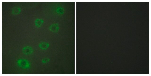 Anti-PTX3 antibody produced in rabbit affinity isolated antibody