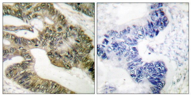 Anti-APC antibody produced in rabbit affinity isolated antibody