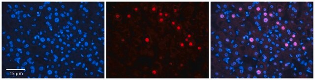 Anti-RAD54B (ab3) antibody produced in rabbit affinity isolated antibody