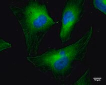 Monoclonal Anti-Cofilin 1 antibody produced in mouse clone GT567, affinity isolated antibody
