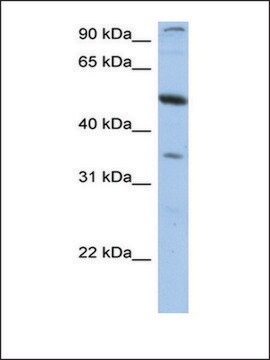 Anti-PLXDC1 antibody produced in rabbit affinity isolated antibody