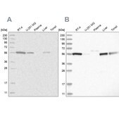 Anti-ALDH5A1 antibody produced in rabbit Prestige Antibodies&#174; Powered by Atlas Antibodies, affinity isolated antibody, buffered aqueous glycerol solution, ab2