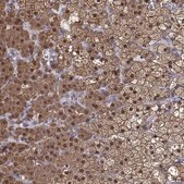 Anti-AKR1B1 antibody produced in rabbit Prestige Antibodies&#174; Powered by Atlas Antibodies, affinity isolated antibody, buffered aqueous glycerol solution