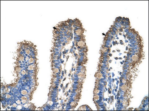 Anti-RHOBTB1 antibody produced in rabbit affinity isolated antibody