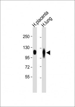 [KO Validated]Anti-LAMP2 antibody produced in rabbit [Knockout Validated],purified polyclonal antibody, buffered aqueous solution