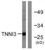 Anti-Tnni3, N-Terminal antibody produced in rabbit affinity isolated antibody