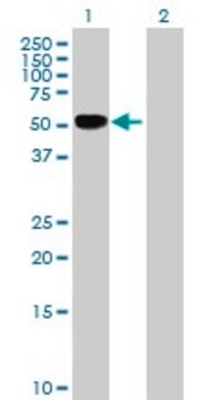 Anti-TNFRSF11B antibody produced in rabbit purified immunoglobulin, buffered aqueous solution
