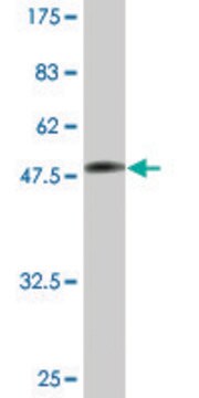 Monoclonal Anti-TPI1 antibody produced in mouse clone 2C3, ascites fluid