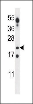 ANTI-CT45A (CENTER) antibody produced in rabbit IgG fraction of antiserum, buffered aqueous solution