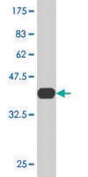 Monoclonal Anti-LIG4, (C-terminal) antibody produced in mouse clone 2D2, purified immunoglobulin, buffered aqueous solution