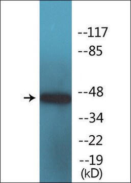 Anti-phospho-Elk3 (pSer357) antibody produced in rabbit affinity isolated antibody