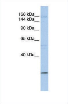 Anti-UBR2 antibody produced in rabbit affinity isolated antibody