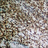 Anti-phospho-HRS (pTyr334) antibody produced in rabbit affinity isolated antibody