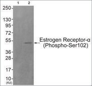 Anti-phospho-Estrogen Receptor-&#945; (pSer102) antibody produced in rabbit affinity isolated antibody