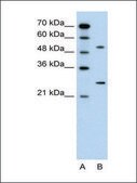 Anti-CACNB1 (AB2) antibody produced in rabbit affinity isolated antibody