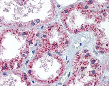 Anti-PTCH1 antibody produced in rabbit affinity isolated antibody