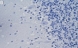Anti-PKC&#947; Antibody, clone 2B9 ZooMAb&#174; Rabbit Monoclonal recombinant, expressed in HEK 293 cells