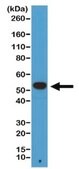 Anti-alpha-Tubulin Antibody, clone RM113 clone RM113, from rabbit