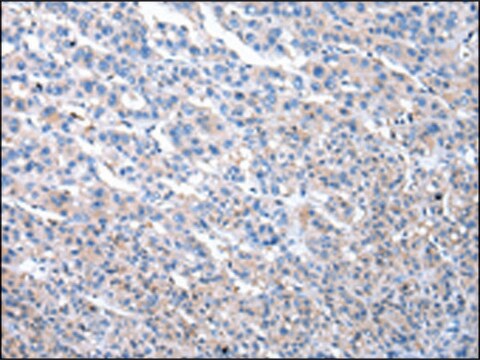 Anti-MASP1 affinity isolated antibody