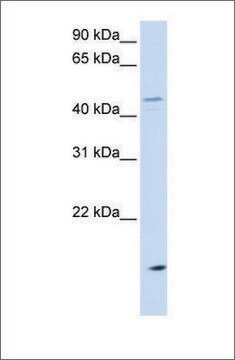 Anti-CETP antibody produced in rabbit affinity isolated antibody