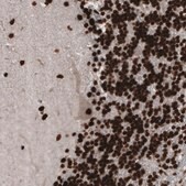 Monoclonal Anti-PARP1 Prestige Antibodies&#174; Powered by Atlas Antibodies, clone CL2209, purified immunoglobulin, buffered aqueous glycerol solution