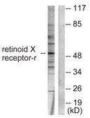 Anti-Retinoid X Receptor &#947; antibody produced in rabbit affinity isolated antibody