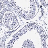Anti-DPP4 antibody produced in rabbit Prestige Antibodies&#174; Powered by Atlas Antibodies, affinity isolated antibody, buffered aqueous glycerol solution
