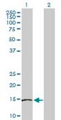 Anti-SKP1 antibody produced in rabbit purified immunoglobulin, buffered aqueous solution