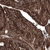 Anti-GSPT1 antibody produced in mouse Prestige Antibodies&#174; Powered by Atlas Antibodies, clone CL13332, purified by using Protein A, buffered aqueous glycerol solution