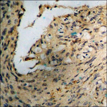 Anti-phospho-Akt (pSer473) antibody produced in rabbit affinity isolated antibody