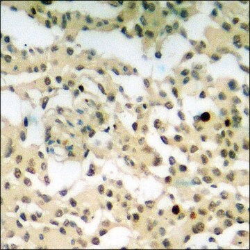 Anti-phospho-NPM (pThr199) antibody produced in rabbit affinity isolated antibody