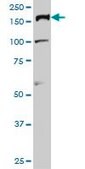 Monoclonal Anti-TOP2A antibody produced in mouse clone 1E2, purified immunoglobulin, buffered aqueous solution
