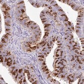 Anti-AGR3 antibody produced in rabbit Prestige Antibodies&#174; Powered by Atlas Antibodies, affinity isolated antibody, buffered aqueous glycerol solution
