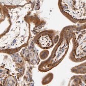 Anti-LAMB1 antibody produced in rabbit Ab2, Prestige Antibodies&#174; Powered by Atlas Antibodies, affinity isolated antibody, buffered aqueous glycerol solution