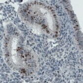 Monoclonal Anti-MKI67 antibody produced in mouse Prestige Antibodies&#174; Powered by Atlas Antibodies, clone CL1234, purified immunoglobulin, buffered aqueous glycerol solution