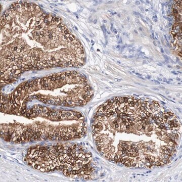 Anti-ACVR1C antibody produced in rabbit Prestige Antibodies&#174; Powered by Atlas Antibodies, affinity isolated antibody, buffered aqueous glycerol solution