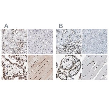 Anti-MEF2D antibody produced in rabbit Ab1, Prestige Antibodies&#174; Powered by Atlas Antibodies, affinity isolated antibody, buffered aqueous glycerol solution