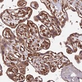 Anti-PDE4D antibody produced in rabbit Prestige Antibodies&#174; Powered by Atlas Antibodies, affinity isolated antibody, buffered aqueous glycerol solution
