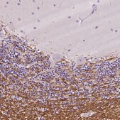 Anti-SIRT2 antibody produced in rabbit Prestige Antibodies&#174; Powered by Atlas Antibodies, affinity isolated antibody, buffered aqueous glycerol solution