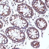 Anti-CLPP antibody produced in rabbit