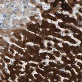 Anti-CYP2E1 antibody produced in rabbit Prestige Antibodies&#174; Powered by Atlas Antibodies, affinity isolated antibody, buffered aqueous glycerol solution