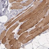 Anti-MB antibody produced in rabbit Prestige Antibodies&#174; Powered by Atlas Antibodies, affinity isolated antibody, buffered aqueous glycerol solution