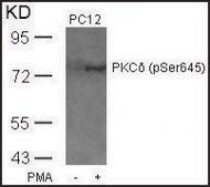 Anti-phospho-PRKCD (pSer645) antibody produced in rabbit affinity isolated antibody