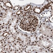 Anti-DNMT3A antibody produced in rabbit Prestige Antibodies&#174; Powered by Atlas Antibodies, affinity isolated antibody, buffered aqueous glycerol solution