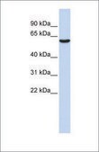 Anti-GABRB3 antibody produced in rabbit affinity isolated antibody