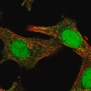 Anti-SOCS4 antibody produced in rabbit Prestige Antibodies&#174; Powered by Atlas Antibodies, affinity isolated antibody