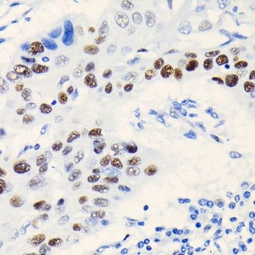 Anti-TCF4/TCF7L2 antibody produced in rabbit