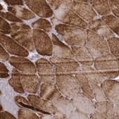 Monoclonal Anti-MYH6 antibody produced in mouse Prestige Antibodies&#174; Powered by Atlas Antibodies, clone CL2148, purified immunoglobulin, buffered aqueous glycerol solution