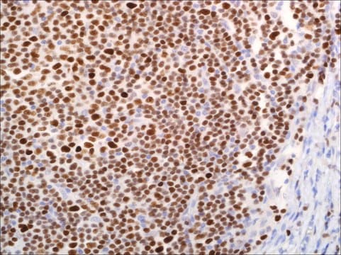 LEF1 (EP310) Rabbit Monoclonal Primary Antibody