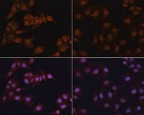 Anti-LC3B antibody produced in rabbit